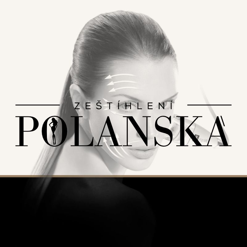 Rosigrafik- webová prezentace Zeštíhlení Polanská